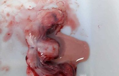 LA IMPORTANCIA DE LA ESTERILIZACIÓN