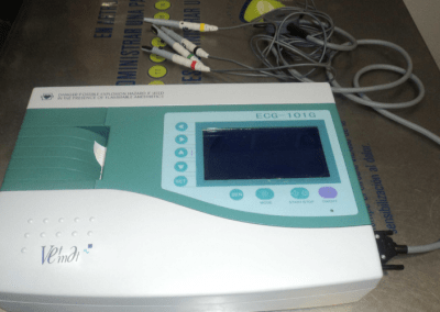 Electrocardiograma